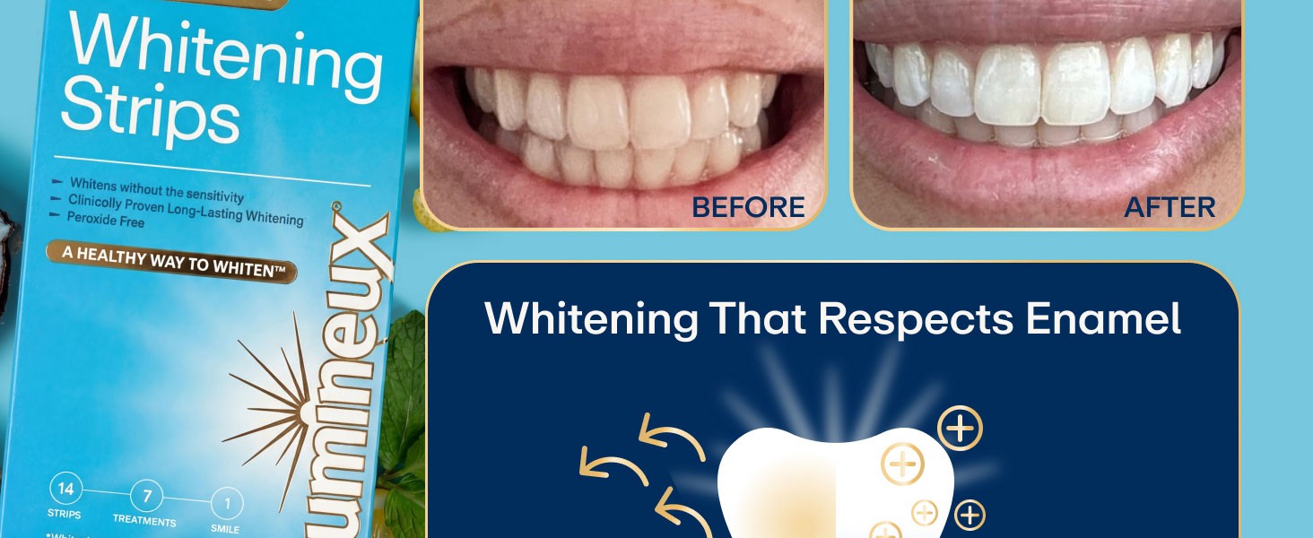 Lumineux Teeth Whitening Strips Review: Safe & Effective Brightening