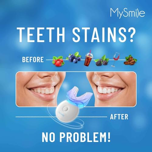 Teeth Whitening Kit Review: Affordable Teeth Whitening Kit