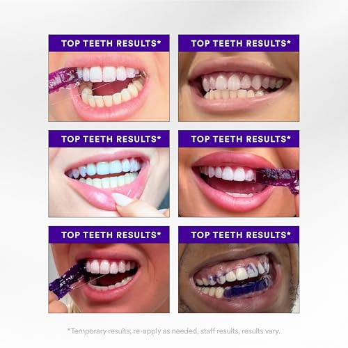 what are the best teeth whitening strips
